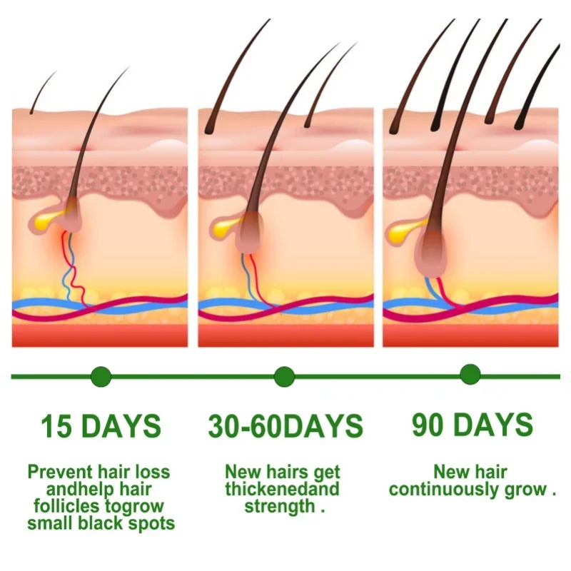 Serum na porost włosów Szybko  – Epidermal Growth Factor recenzja i cena