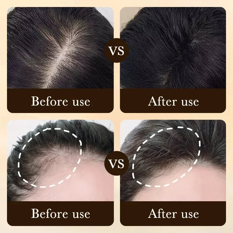 Produkty do pielęgnacji włosów – Epidermal Growth Factor recenzja i cena
