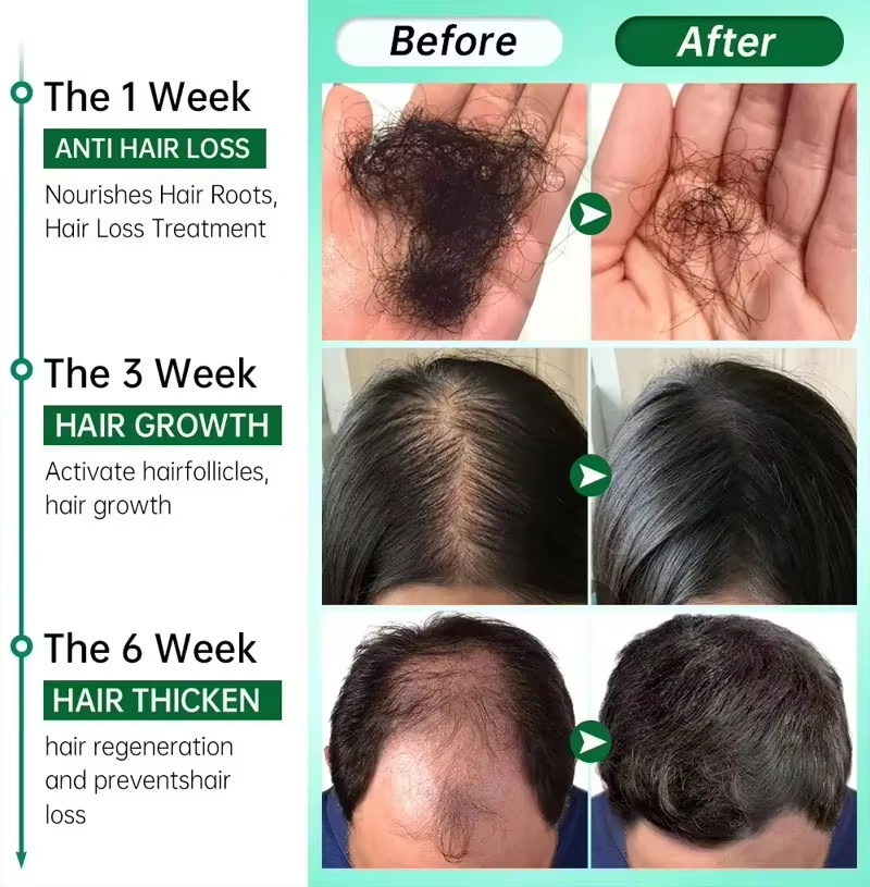 Serum na porost włosów 7-dniow – Epidermal Growth Factor recenzja i cena